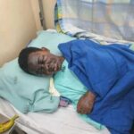 Lady Clare who was burnt on the face with sulphuric acid